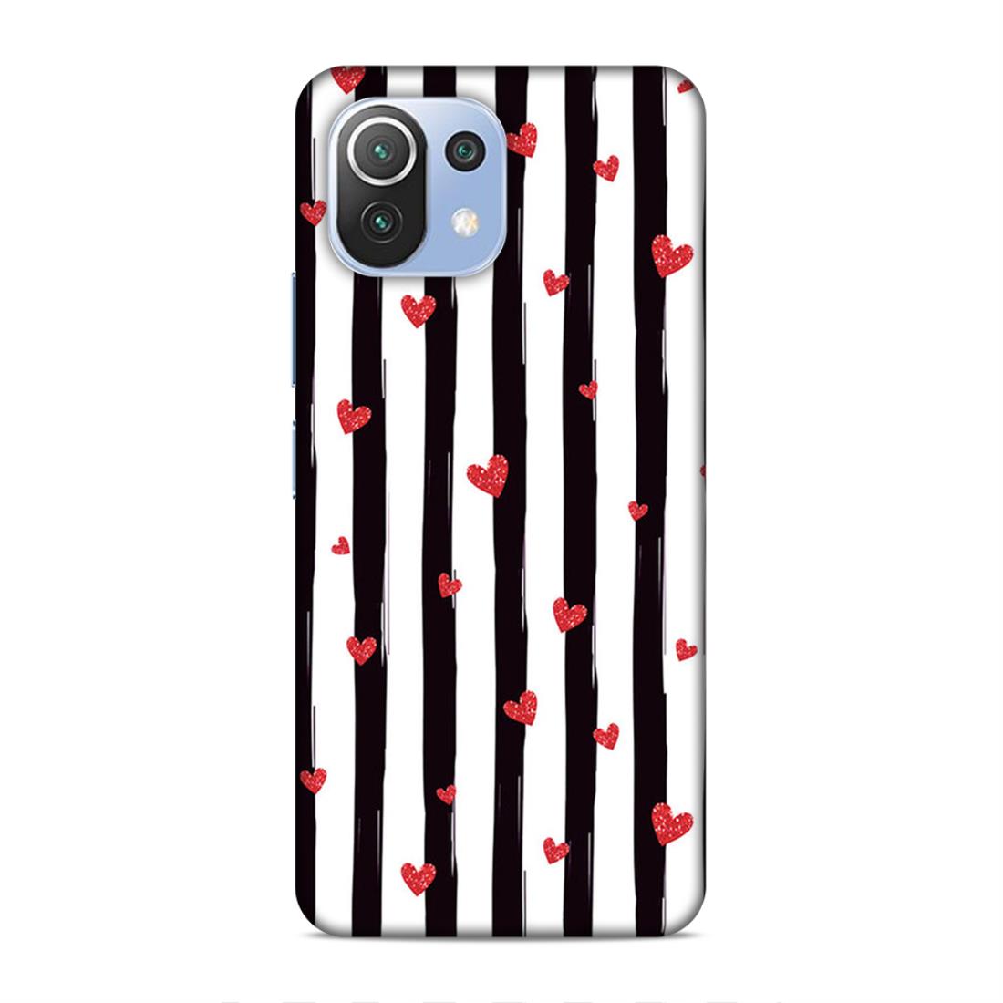 Little Hearts with Strips Hard Back Case For Xiaomi Mi 11 Lite